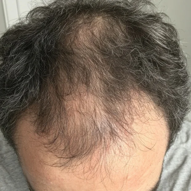 Restauração Capilar Completa - Antes