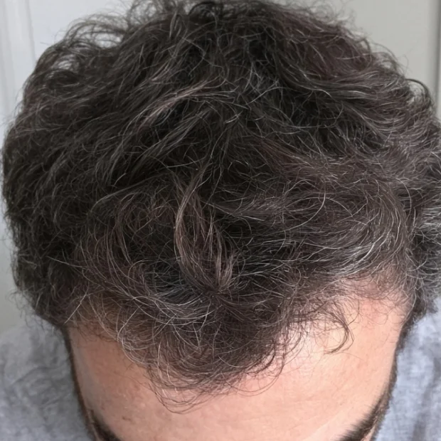 Restauração Capilar Completa - Depois